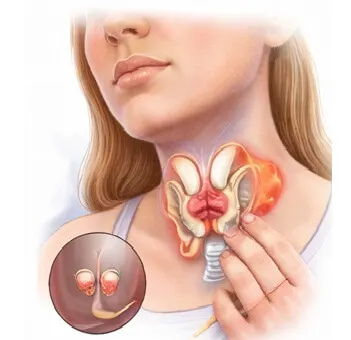 Homeopathic thyroid treatment in Pathankot by Dr Abinash Sharma